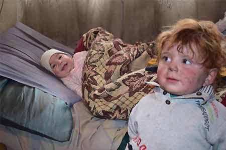 FAO representative: 9.6% of children under five years old are  undernourished in Armenia